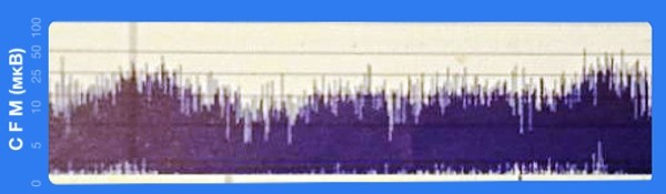 
			Терапевтическая гипотермия в неонатологии		