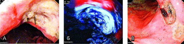 
			Острая гастродуоденальная боль. Часть 2		