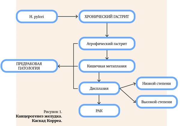 Природа хронической гастродуоденальной боли. Часть 1
Природа хронической гастродуоденальной боли. Часть 1