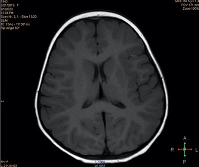 
			Пароксизмальные состояния у детей неэпилептического характера		