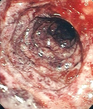 
			Острая гастродуоденальная боль. Часть 2		