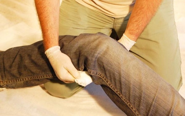 
			Первая помощь при острой кровопотере и травматическом шоке		