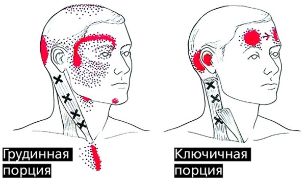«Замороженные в мышцах чувства»: как связаны тревога, депрессия и боль?
«Замороженные в мышцах чувства»: как связаны тревога, депрессия и боль?
