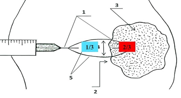 
			Патогистологическое сопровождение при диагностике заболеваний		