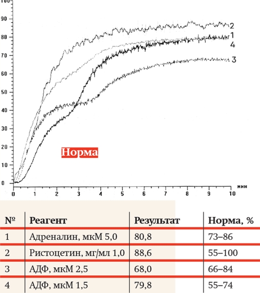 
			Агрегатометрия: нюансы прочтения анализов		